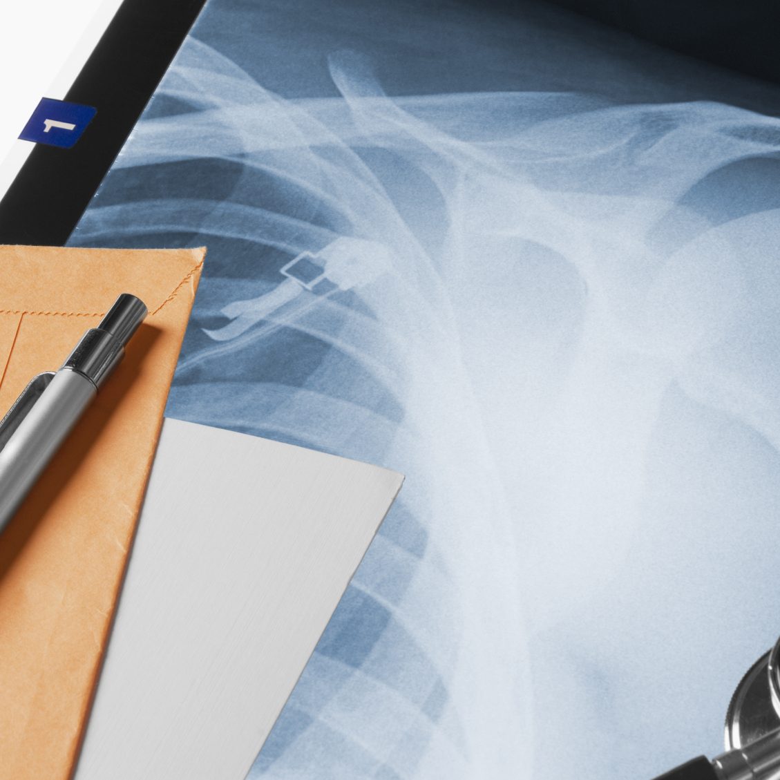Mehr dazu im Ratgeber BU-Risikoprüfung Röntgenaufnahme eines Schulteils neben Schreibmaterial und einem Stift. Diagnosen in der BU-Versicherung