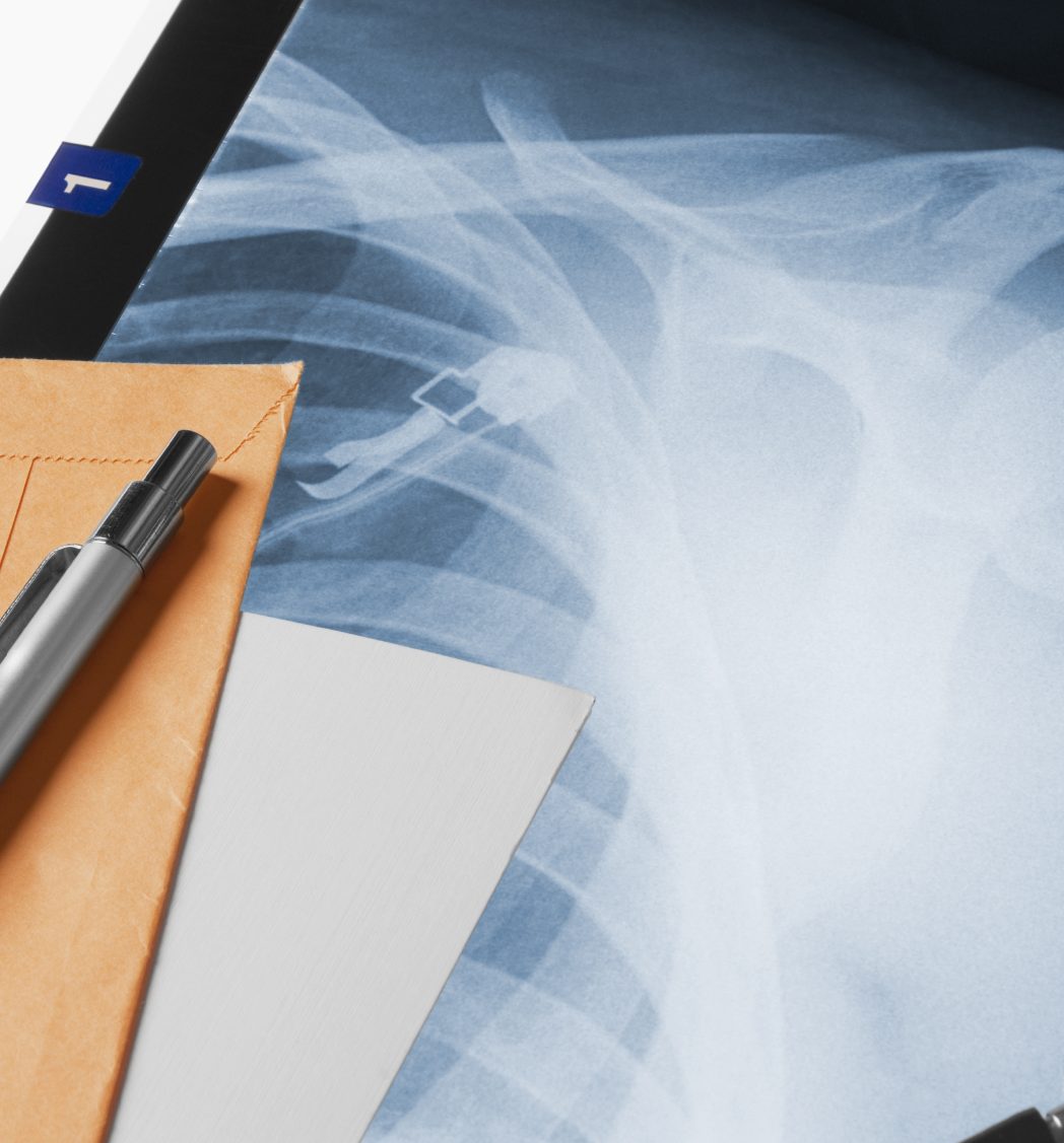 Nach Diagnosen Röntgenaufnahme eines menschlichen Schulteils mit Schreibutensilien und Dokumenten.